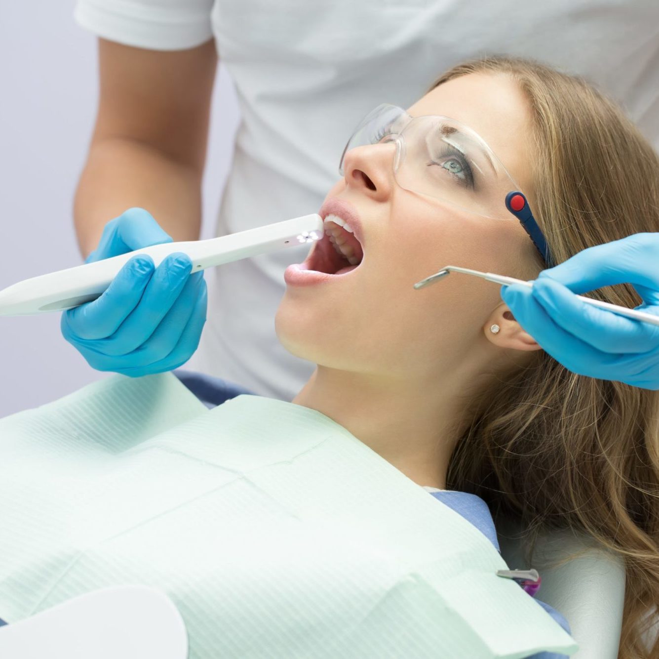Featured image for “Dental Bonding”